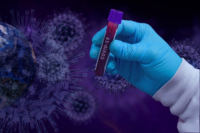В Югре за сутки выявили 151 новый случай заражения коронавирусом