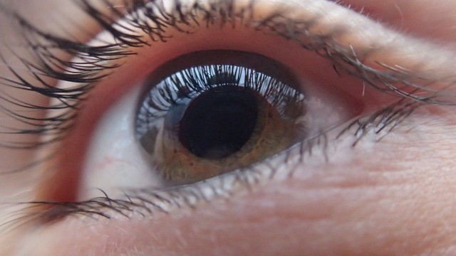 Тюменские врачи прооперировали 18-летнюю девушку с катарактой