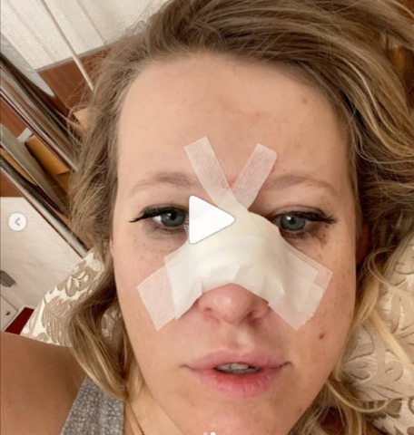 Ксения Собчак госпитализирована с травмой носа