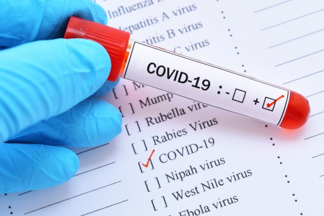 В Югре выявили ещё 78 случаев COVID-19