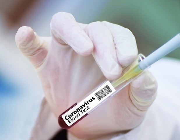 Молодые переносят прививку от COVID-19 тяжелее, чем люди постарше из-за разной реакции организма