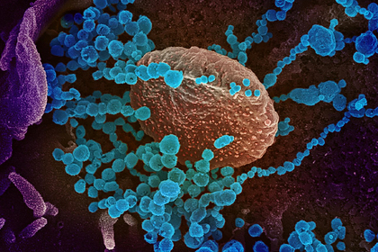 В ХМАО более 2300 исследований на коронавирус результативно напрягли югорчан