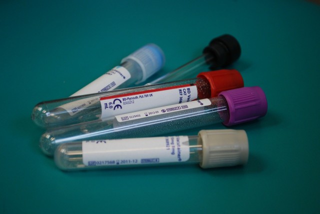 ​В Ноябрьске срочно требуется донорская кровь из-за пандемии коронавируса