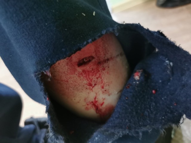 В Мегионе на ребенка напала собака В Мегионе на ребенка напала собака