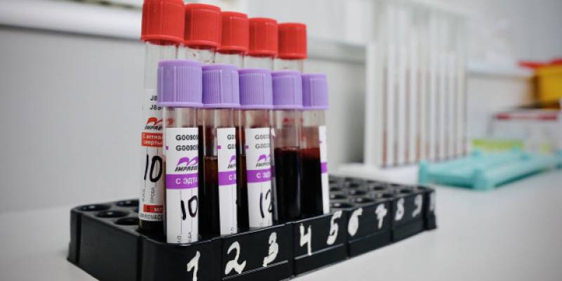 Врач раскрыла масштаб распространения ВИЧ в ХМАО