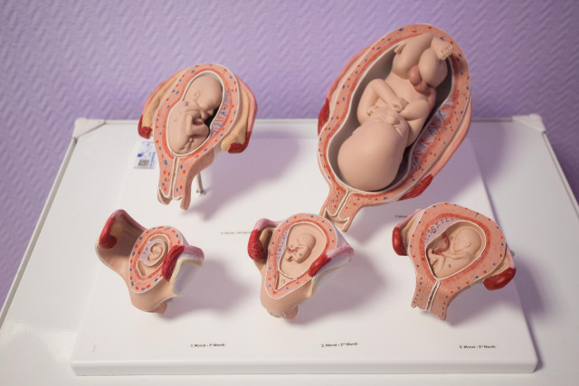 Опухоль размером с авокадо удалили беременной девушке врачи из ХМАО Опухоль размером с авокадо удалили беременной девушке врачи из ХМАО