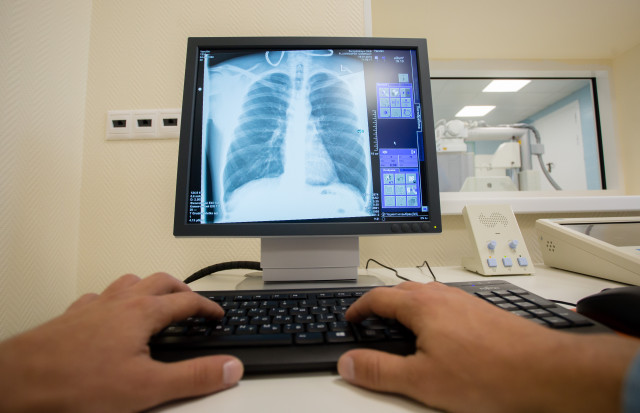 Дыра в легком образовалась у ребенка из ХМАО из-за серьезной пневмонии