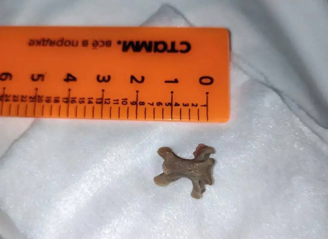 Позвонок рябчика вдохнул житель ХМАО во время еды