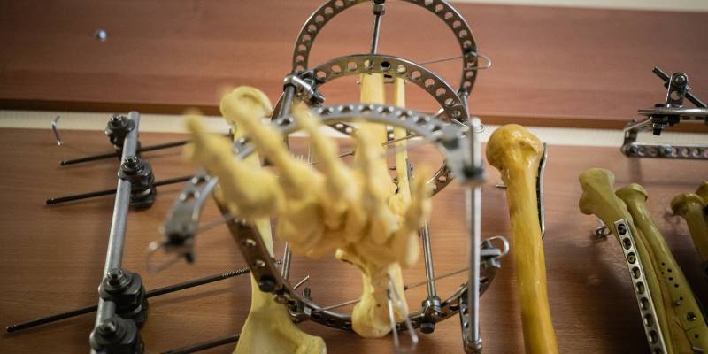 В ХМАО лечат подростка от редкого генетического рахита