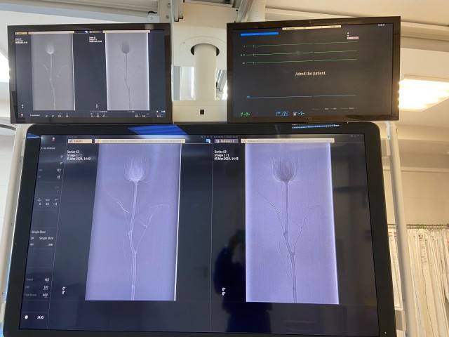 Патологий не обнаружено: врачи в ХМАО просканировали розу рентгеном