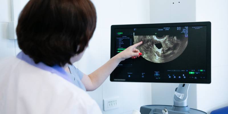 Опухоль размером с тыкву вырезали врачи у жительницы Нижневартовска