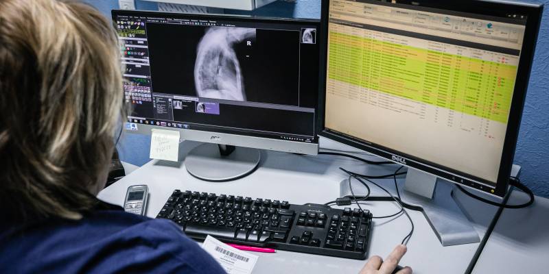 Житель ЯНАО резко открыл дверь и порвал сухожилие