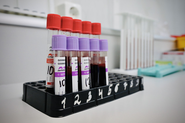 Врач раскрыла масштаб распространения ВИЧ в ХМАО