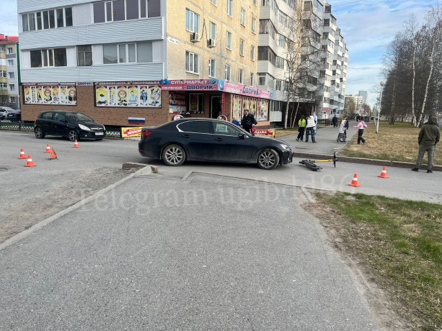 В ХМАО подросток на электросамокате врезалась в «Лексус» и получила травмы