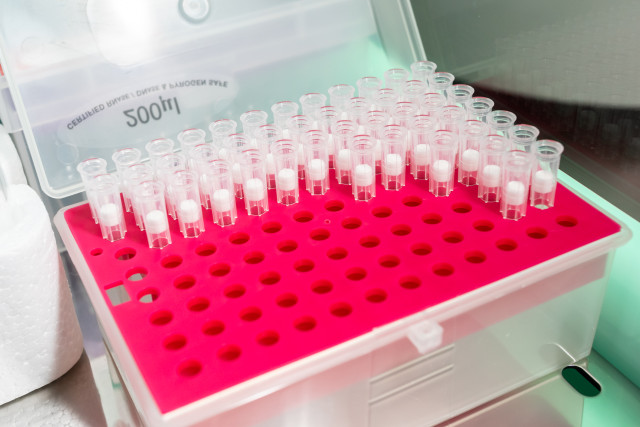 Из ХМАО выдворили 65 мигрантов, которые были переносчиками опасных инфекций