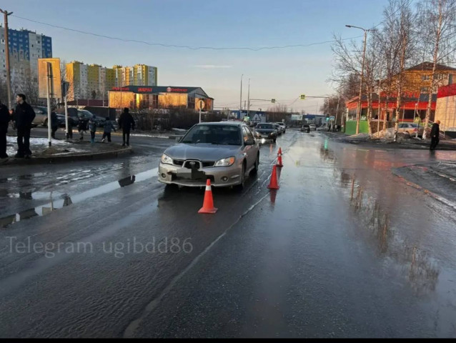 В Пыть-Яхе подросток выбежал под колеса авто и попал в больницу