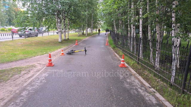 В Нижневартовске женщина на электросамокате сбила ребенка В Нижневартовске женщина на электросамокате сбила ребенка