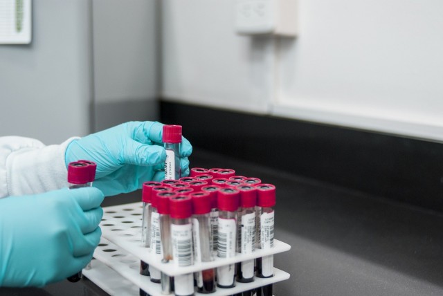 В Югре за сутки зарегистрировали 14 новых случаев коронавируса