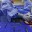 В Тюмени врачи удалили у 9-летней девочки редкую опухоль