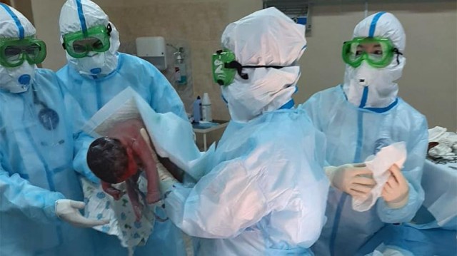 В Ноябрьской ЦГБ прооперировали двух беременных женщин с COVID-19